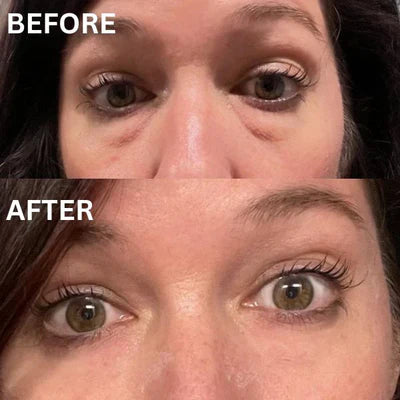 Collagen Infusion Tightening Eye LiftPatches™