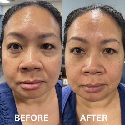 Collagen Infusion Tightening Eye LiftPatches™